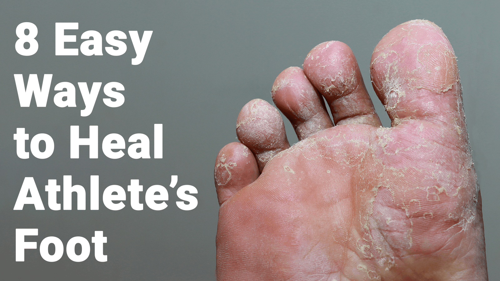 8-easy-ways-to-heal-athlete-s-foot